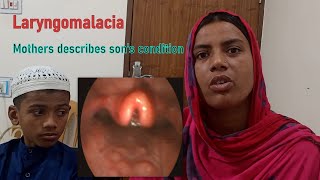 Laryngomalacia Laryngoscopy amp Clinical Feature। Natural History। Mother Describes Sons Condition [upl. by Fitts]