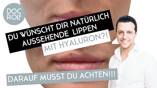 LIPPENUNTERSPRITZUNG MIT HYALURONSÄURE– darauf musst du unbedingt achten [upl. by Hctud]