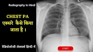 Chest Xray 2  Chest PA View Explained in Hindi radiographyinhindi xrayclasses xraytechnician [upl. by Normac]