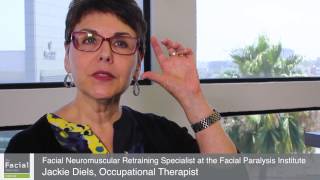 Neuromuscular Retraining for Facial Paralysis After Bells Palsy  Beverly Hills [upl. by Verity676]