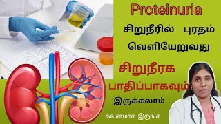 சிறுநீரில் புரதம் போவதால் காணப்படும் அறிகுறிகள் Proteinuria causes and symptoms [upl. by Adelind]