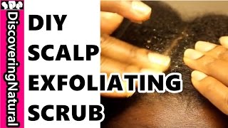 DIY Scalp Scrub for Exfoliating Scalp Health [upl. by Yenohtna]