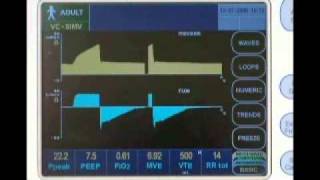 Newport e360 Ventilator Overview [upl. by Aurelia]