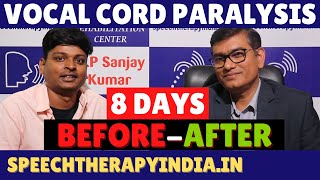 BeforeAfter  Unilateral Vocal Cord Paralysis Phonatory Gap  8 Days Voice Therapy  AIIMS Alumnus [upl. by Shel]