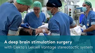 A DBS surgery with Elektas Leksell Vantage stereotactic system [upl. by Enawd969]