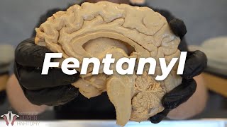 Why Fentanyl Is So Incredibly Dangerous [upl. by Thrift300]