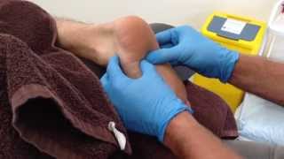 Dry Needling for Pain Relief  An Expert Perspective [upl. by Enilatan]