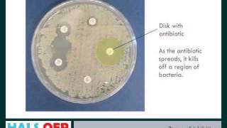 Microbiology resources  How to Measure Zones of Inhibition ZOI [upl. by Kennard]