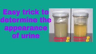 How to assessment the appearance of urine easily appearance of urine urine analysis urine test [upl. by Hillell]