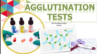 Types of Agglutination tests [upl. by Orhtej]