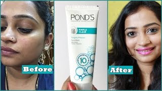 Ponds Pimple Clear Face Wash Review  How to remove Pimple using Face wash  Effective Face Wash [upl. by Longawa]