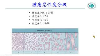 2020年12月攝護腺癌病友會「攝護腺癌簡介及達文西機器手臂微創手術之運用」陳正哲醫師 [upl. by Ullyot219]