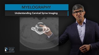 What is Myelography​ of the Cervical Spine [upl. by Eeryn]