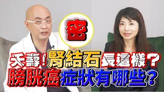 常染髮膀胱癌機率大增？避免長出結石 這招必學！ feat洪士奇醫師｜李曉菁主播 JudyVlog [upl. by Aradnahc75]