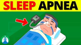 What is Sleep Apnea Obstructive vs Central Sleep Apnea [upl. by Accire137]