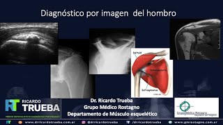 DIAGNOSTICO POR IMAGENES DEL HOMBRO [upl. by Acirret837]