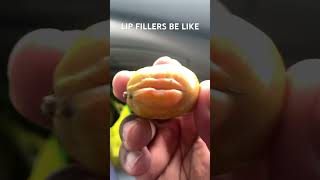 Lip Fillers Be Like… funny shorts viral [upl. by Laney]