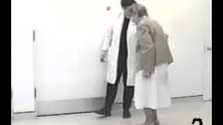 Parkinsonian shuffling gait [upl. by Llewellyn]