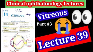 persistent primary vitreous hyperplasia Disorders of vitreous Ophthalmology lectures 39 part 3 [upl. by Novia]