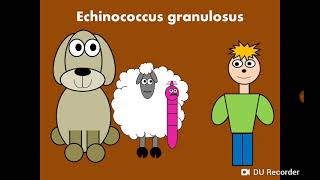 Hydatid disease Echinococcus granulosus التكيس المائي [upl. by Gottwald995]