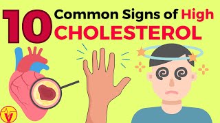 10 Common Signs of High CHOLESTEROL You SHOULD NOT Ignore  VisitJoy [upl. by Enelyk]