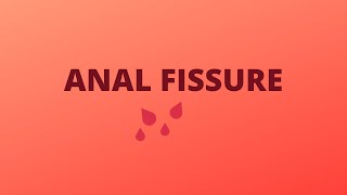 Anal Fissure  DefintionTypesCausesSigns amp SymptomsDiagnosisTreatment [upl. by Adele]