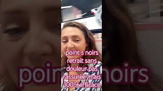 RETRAIT SANS DOULEUR POINTS NOIRS GRACE AU SOIN Déroulement du soin complet voir video ma chaine [upl. by Noitna]