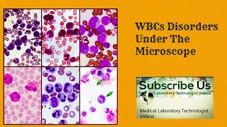 WBC Disorders Under The Microscope [upl. by Watters]