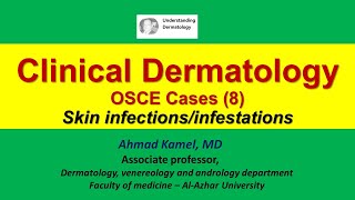 Clinical Dermatology OSCE Cases 8 Skin Infections and Infestations [upl. by Kilar]