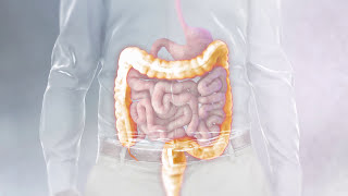 Understanding the Jpouch surgical procedure [upl. by Ahsemad]