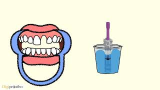 Customized Implant Impression Post to capture the desired emergence profile [upl. by Yenffad]