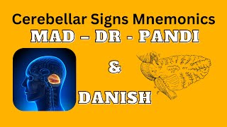 Cerebellar Signs Mnemonics  MAD DR PANDI amp DANISH [upl. by Ahsahtan]