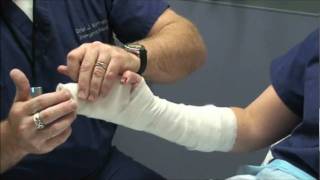 Splint Workshop 3  Ulnar Gutter Splint [upl. by Roberson957]