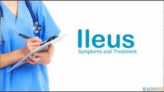 Ileus Symptoms and Treatment [upl. by Nnylaehs]