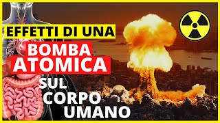 Effetti di una bomba nucleareatomica sul corpo  Rischi sulla salute della guerra UcrainaRussia [upl. by Randell]