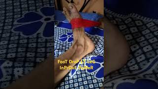 FOOT DROP PATIENT INPROVE POWER PERONEAL NERVE palsy physiotherapy exercise [upl. by Jacinda607]