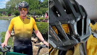 Gordon Ramsay Bike Accident And Shows Off Massive Bruise In Video [upl. by Antonius]