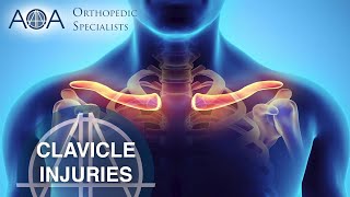 AOA Orthopedic Specialists  Clavicle Injuries [upl. by Ainekahs]