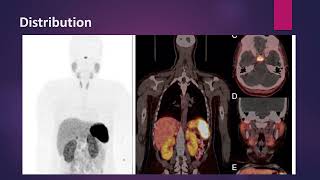 Neuroendocrine Tumors imaging with Ga 68 Somatostatin analogs MCQ nuclearmedicineMCQ [upl. by Behre768]