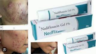 Nedflix Gel Nadifloxacin Gel 1 [upl. by Northington]