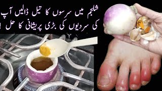 CHILBLAINS Treatment  Home Remedy For Swollen Fingers During Winter [upl. by Aicyla963]