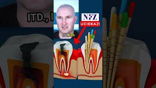 😱Leczenie🦷 na NFZ😳 leczeniekanałowe nfz dentystaopole stomatologopole mikrostomart [upl. by Rosene671]