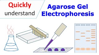 Agarose gel electrophoresis [upl. by Kaia]