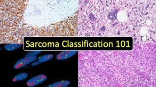 Sarcoma Classification 101 Soft Tissue Tumor Naming Made Simple for Beginners amp NonPathologists [upl. by Berthold]