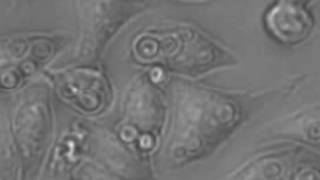 Cryptococcus neoformans migrating between macrophages [upl. by Adihsaar]