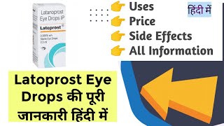 Latoprost Eye Drops Uses Benefits Price Side Effects Full Information in Hindi [upl. by Ezalb]