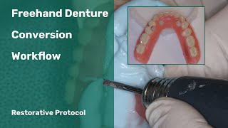 Freehand Denture Conversion Restorative Dental Workflow [upl. by Steffie965]