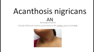 Medicine 1175 Acanthosis nigricans causes insulin resistance treatment skin dermatology dark line [upl. by Berman]