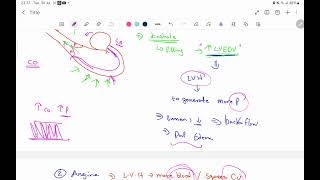 Valvular heart disease Aortic valvepart 2 [upl. by Dixon381]