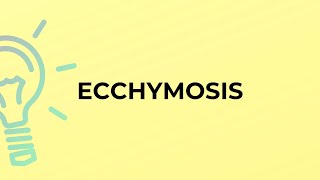 What is the meaning of the word ECCHYMOSIS [upl. by Aisatsanna675]